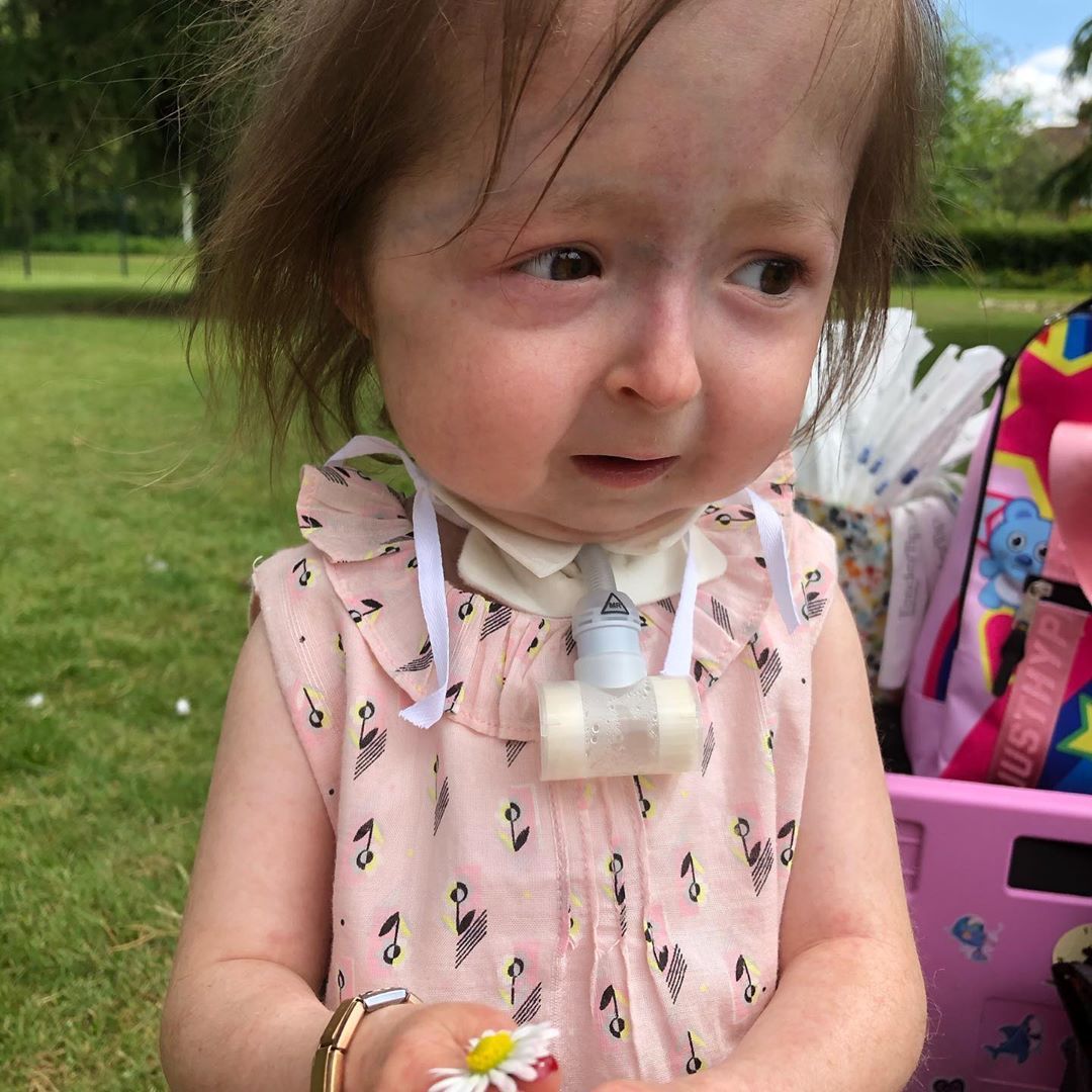 ‘The Only One in the World’: Girl, 3, With a Rare Genetic Mutation Is a Little Fighter